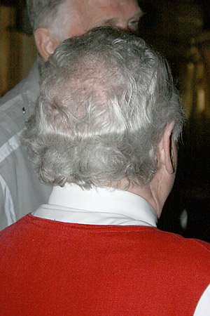 Knaubers Hinterkopf mit Druckspuren der Mütze